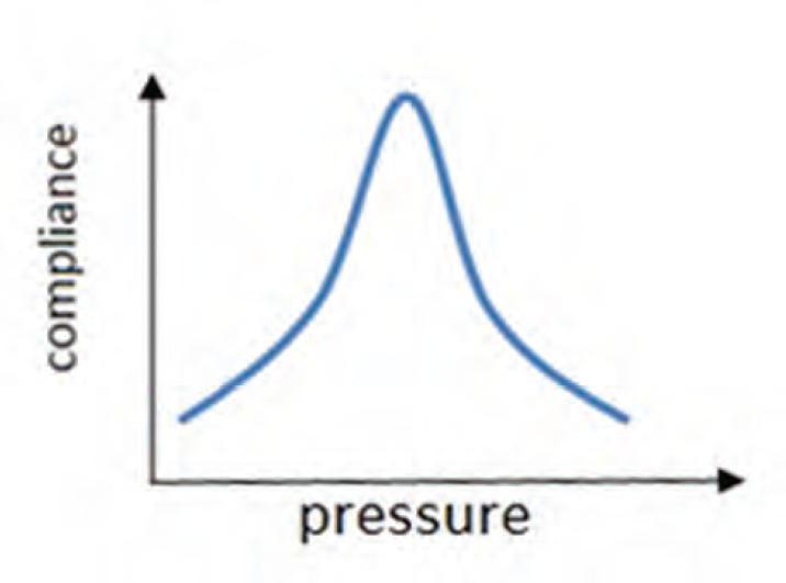 The 1,000-Hz tympanogram—diagrammatic representation.