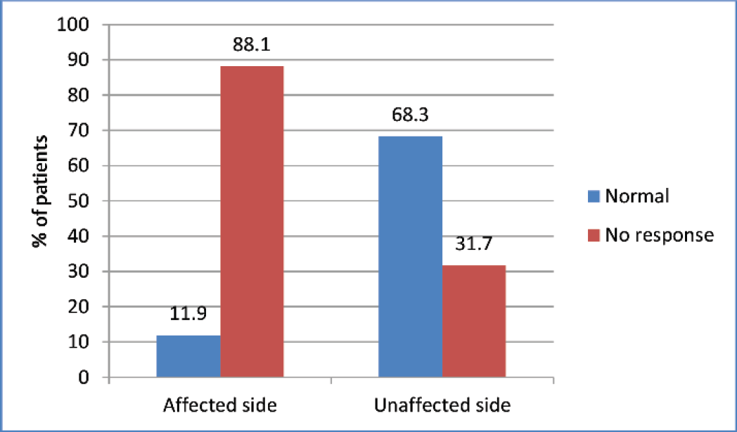 Bar graph showing comparison of stapedial reflex on affected and unaffected sides.