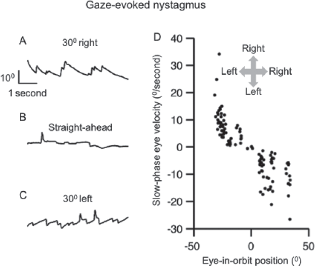 (A-C) Example of gaze-evoked nystagmus in a patient with cerebellar atrophy. Panel A depicts left drifts and right beats during rightward gaze holding, panel B is straight ahead (stable) gaze holding, while panel C is leftward gaze holding leading to right drifts and left beats. In panels A to C, eye position is plotted on the y-axis while corresponding time is plotted on the x-axis. Only horizontal eye positions are shown. (D) The summary of slow-phase velocity is plotted on the y-axis while corresponding eye-in-orbit position is on the x-axis. Each dot depicts one slow phase. Arrows in inset depict the direction. This figure was reproduced from Shaikh et al.53, with permission.