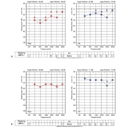 Article figure