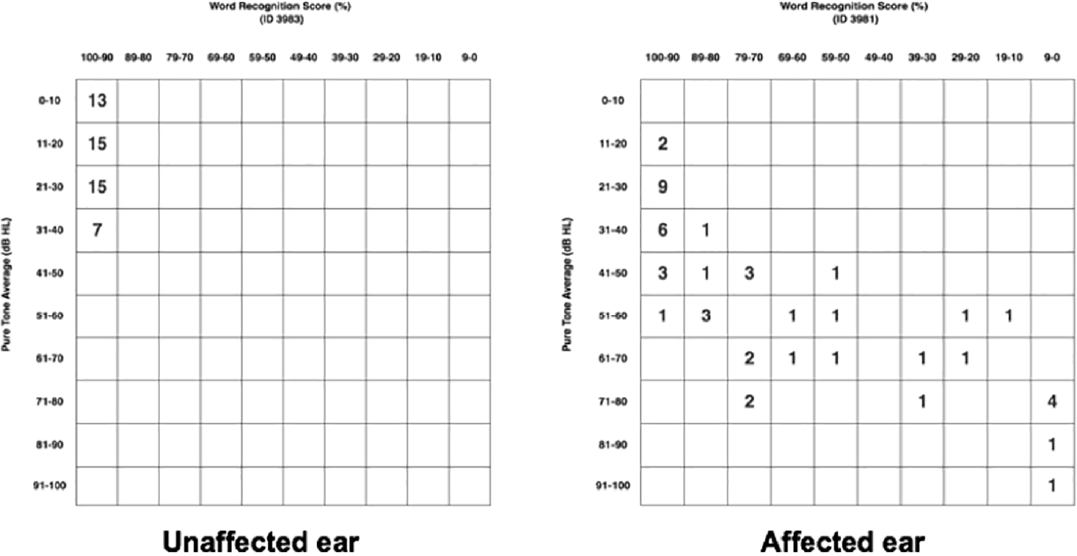 American Academy of Otolaryngology-Head and Neck Surgery scattergrams for both unaffected and affected ears are shown. Word recognition score (WRS) (%) is shown on the x-axis and pure tone average (PTA (dB) on the y-axis. The frequency of patients whose audiometric data places them within those PTA and WRS parameters is represented numerically within the squares