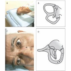 Article figure