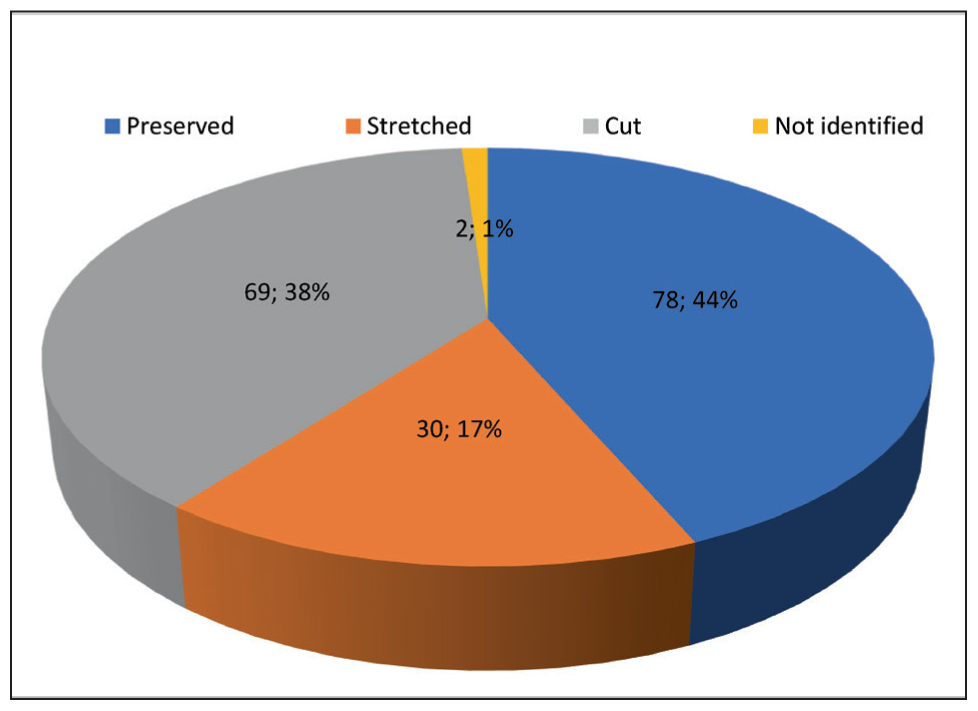 Fate of chorda tympani in different middle ear surgeries.